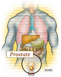 Prostate