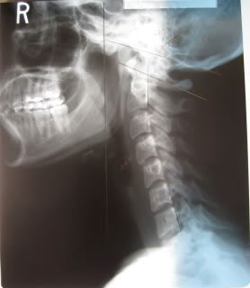 military-neck-xray